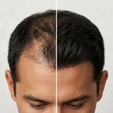 Hair Tonic | Crecimiento Capilar 2X1