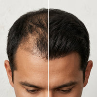 Hair Tonic | Crecimiento Capilar 2X1