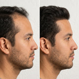 Hair Tonic | Crecimiento Capilar 2X1